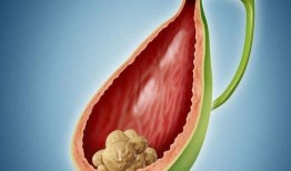 胆囊节食吃瓜好吗,节食吃瓜的合理选择